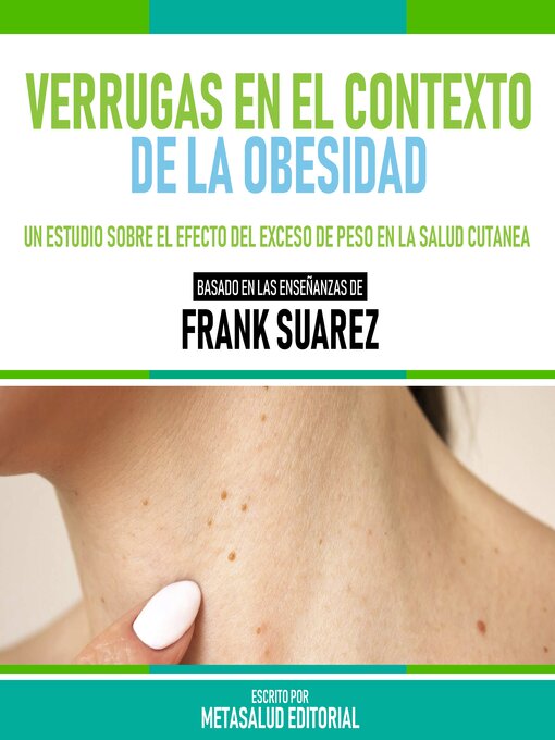 Title details for Verrugas En El Contexto De La Obesidad--Basado En Las Enseñanzas De Frank Suarez by Metasalud Editorial - Available